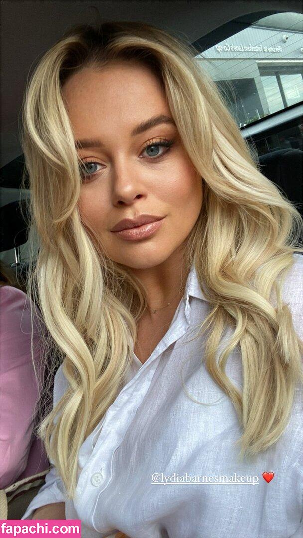 Emily Atack Emilyatack Leaked Nude Photo From Onlyfans Patreon