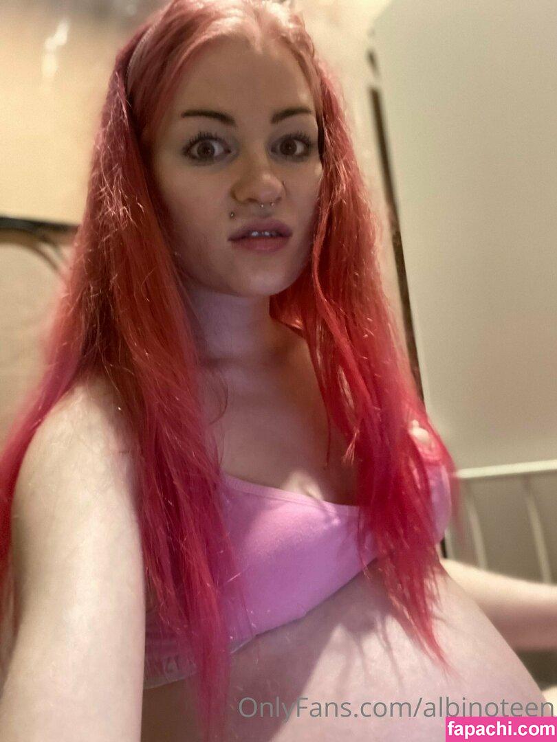 albinoteen leaked nude photo #0004 from OnlyFans/Patreon