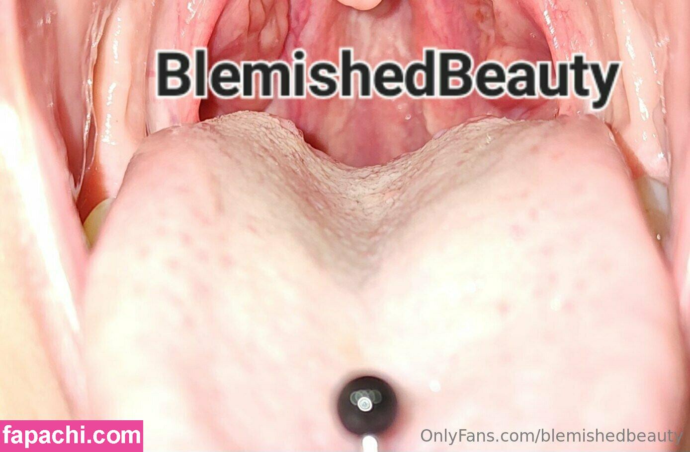 blemishedbeauty leaked nude photo #0111 from OnlyFans/Patreon