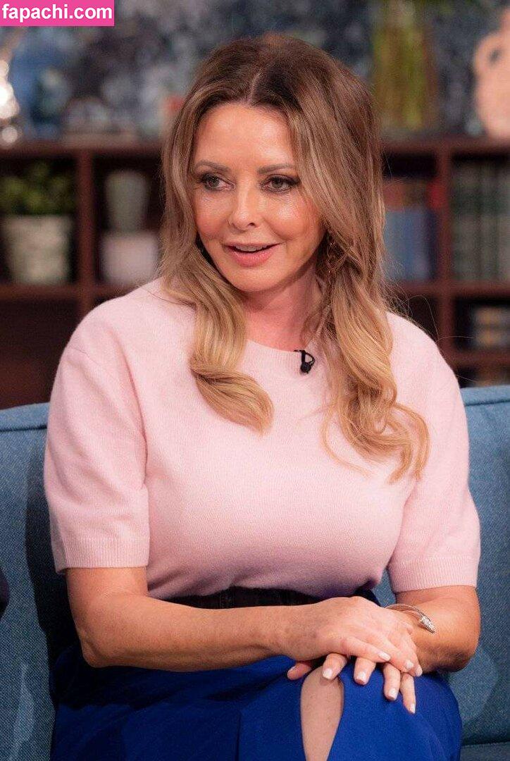 Carol Vorderman / carolvorders leaked nude photo #0638 from OnlyFans/Patreon