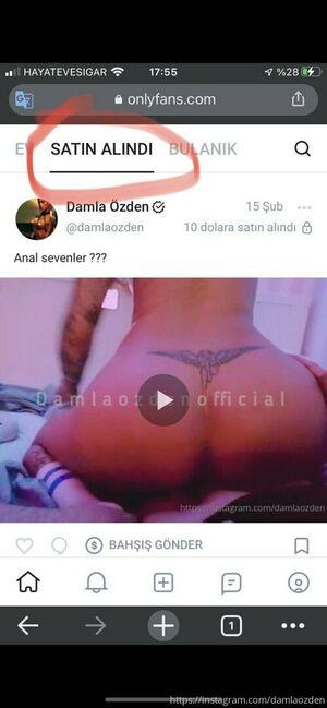 damlaozden leaked media #0013