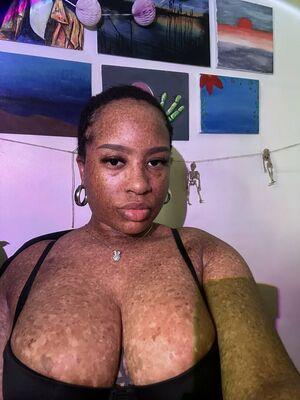 freckledn leaked media #0041