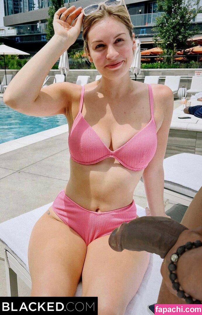 Hannah Alyward / Burcaw / hannahayl leaked nude photo #0020 from OnlyFans/Patreon