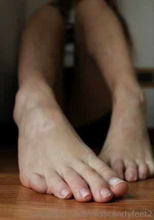 misscandyfeet2 leaked media #0076